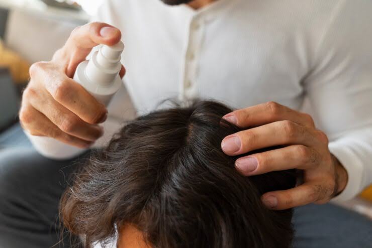 How to Combat Hair Loss: Effective Solutions in Singapore